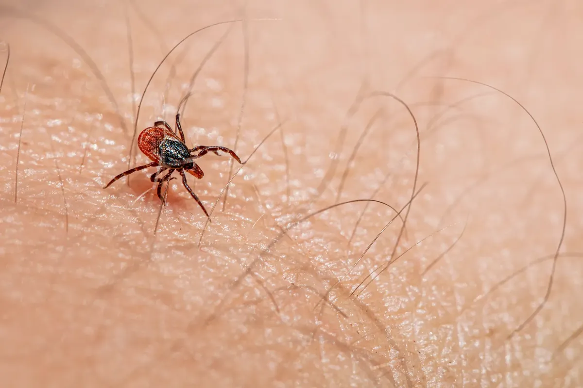 Macro image of a red tick crawling on human skin, highlighting parasitic nature.